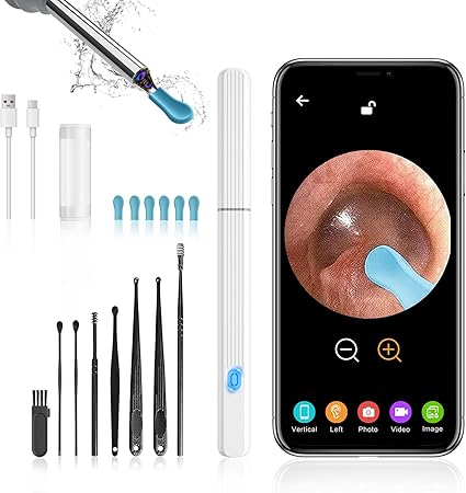 1080P WiFi Ohrreiniger mit Kamera | Ohrenschmalz Entferner, Endoskop mit 360° Sicht & 6 LEDs â IP67 Wasserdicht
